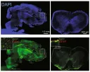 Investigadores del Brigham and Women's Hospital de Boston encuentran astrocitos anti-inflamatorios dirigidos por la microbiota intestinal
