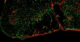 Investigadores de la Universidad de Buffalo revelan cómo el cerebro inhibe la remielinización en un modelo animal de EM y cómo tratarla