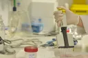 La Asociación de Pacientes EM España colabora con la REEM con 50.000 euros para financiar dos proyectos de investigación en EMPP